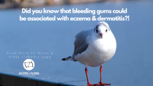 Association of bleeding gums and eczema was demonstrated in a clinical publöication