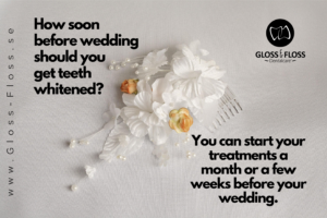 When is the best time to start a wedding smile make over in advance of your ceremony?