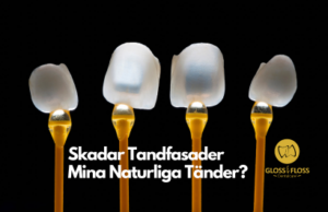 Skadar tandfasader naturliga tänder?