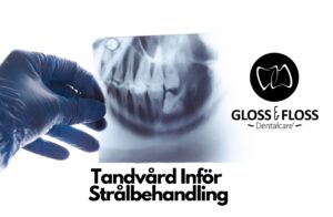 Tandvård både före och under strålbehandling hos Gloss & Floss Dental Care i Stockholm.